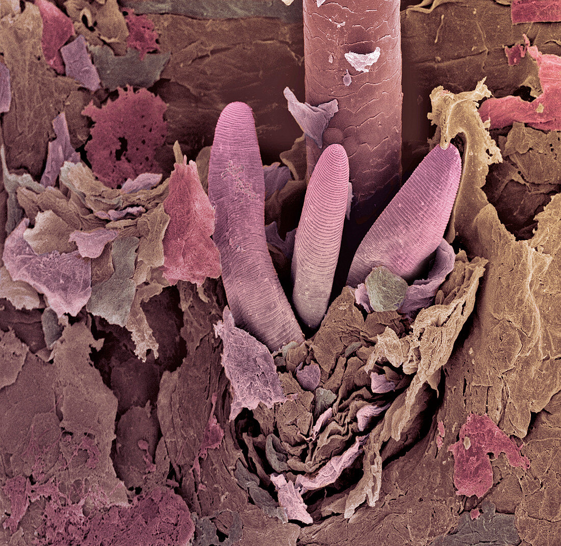 Eyelash mite tails,SEM