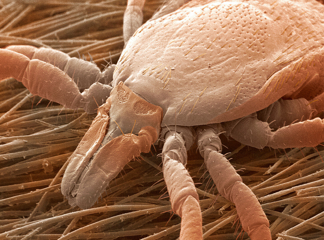 Sheep tick,SEM