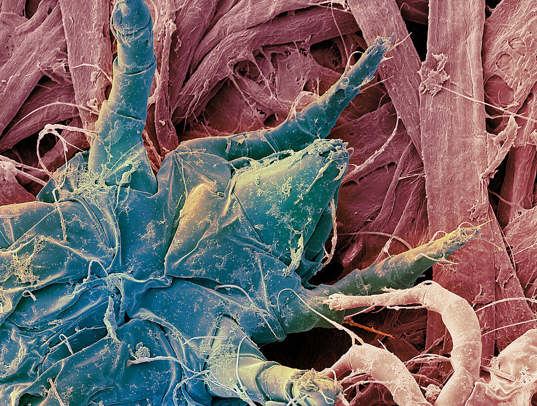 Dust mite,SEM