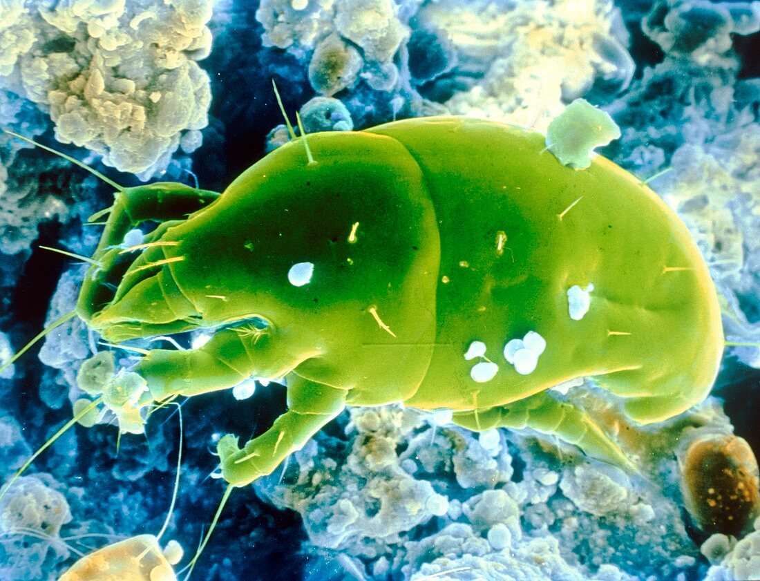 False-colour SEM of an unidentified dust mite