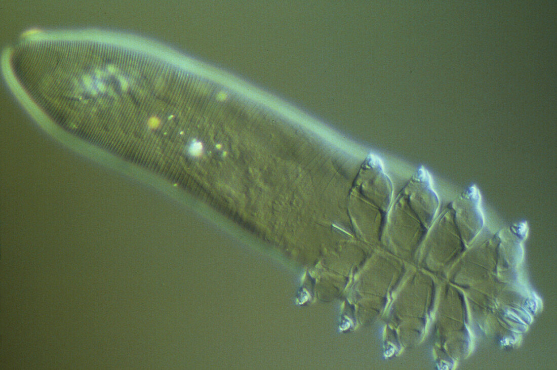 LM of Demodex folliculorum