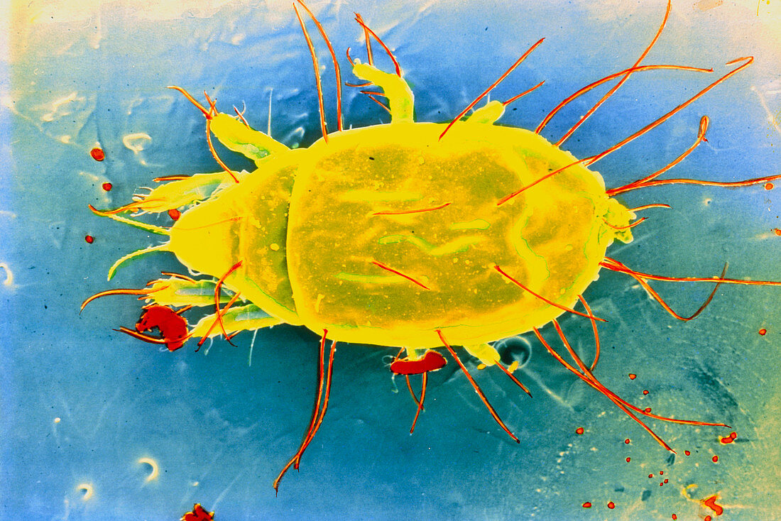 False-colour SEM of dust mite