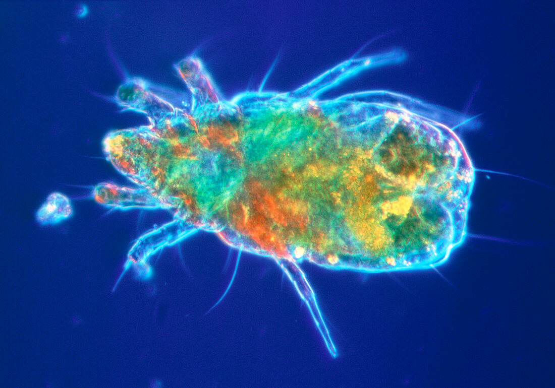 LM of a dust mite,Dermatophagoides sp