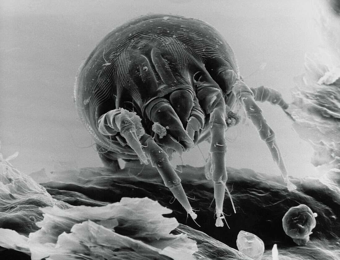 SEM of a dust mite