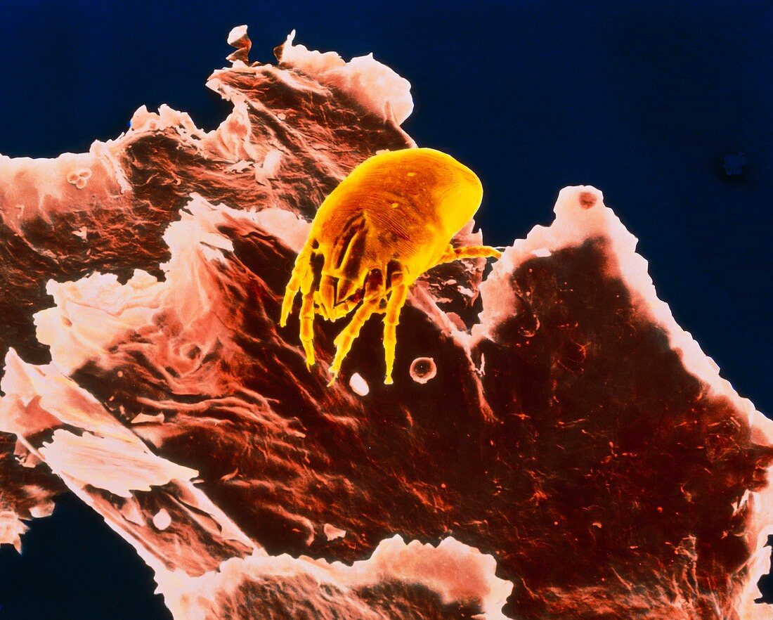 Coloured SEM of a dust mite on dandruff