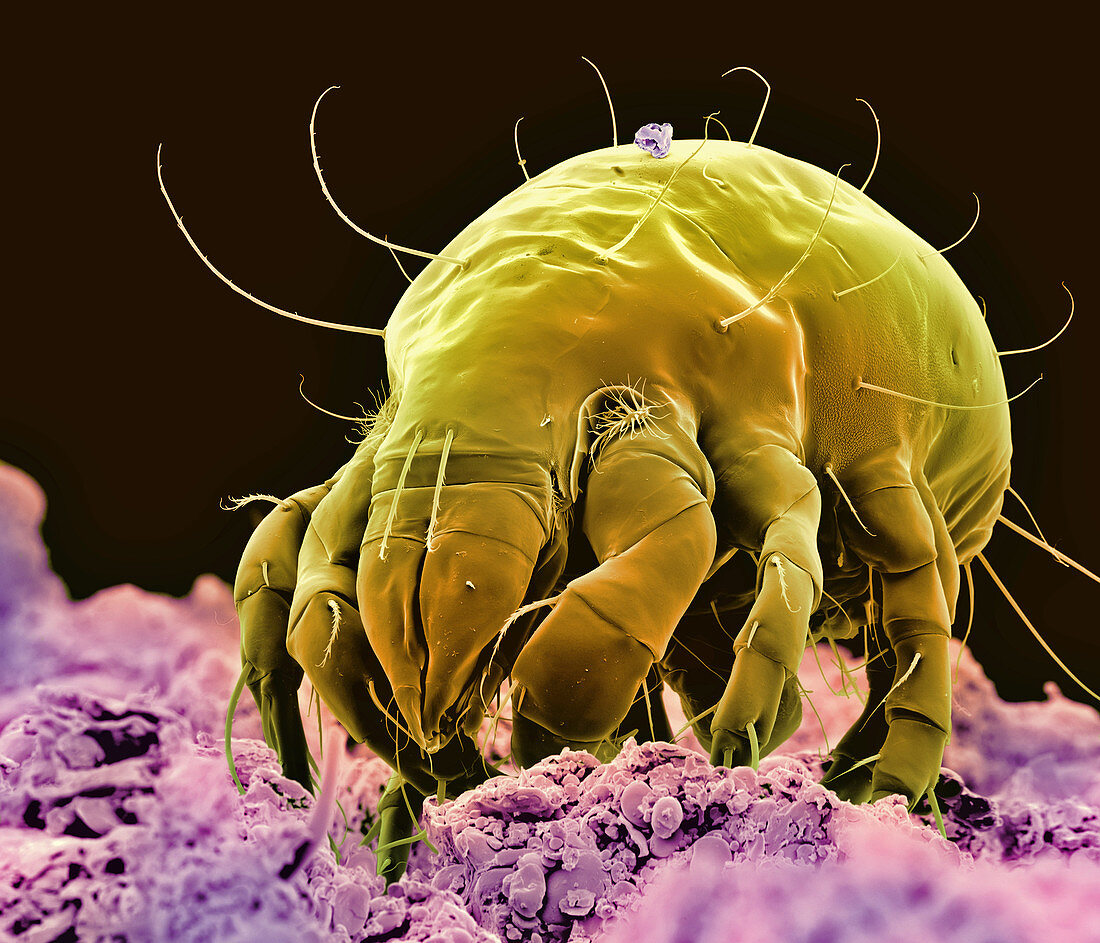 Coloured SEM of a meal mite (Acarus siro)