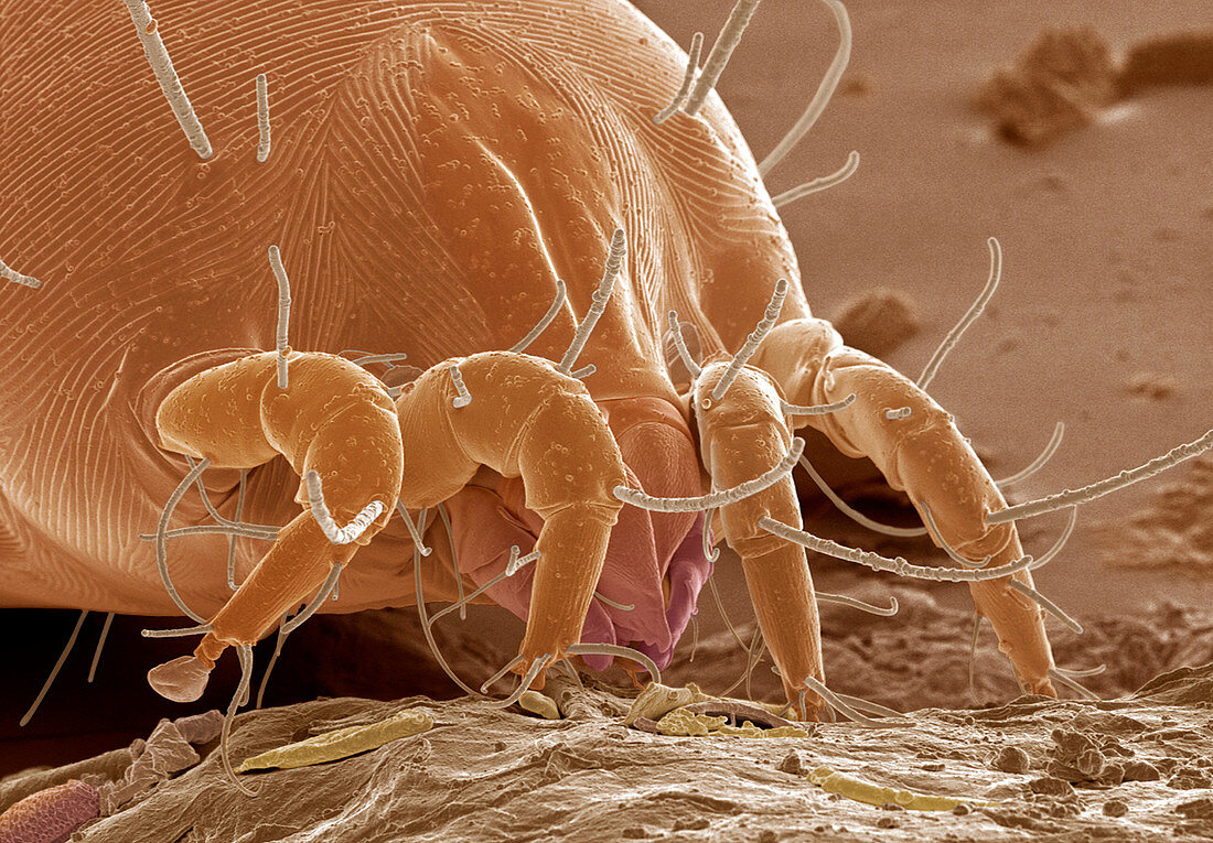 Dust mite