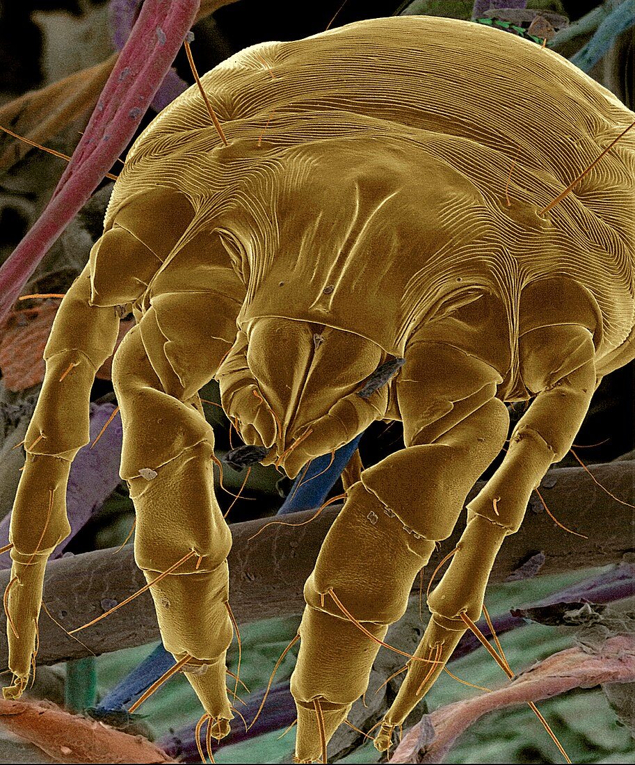 Dust mite,SEM