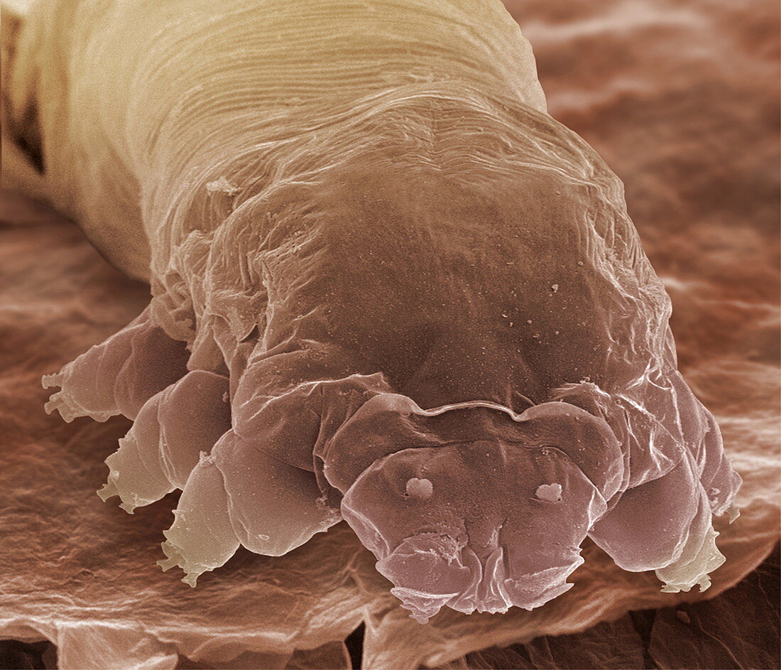 Eyelash mite,SEM