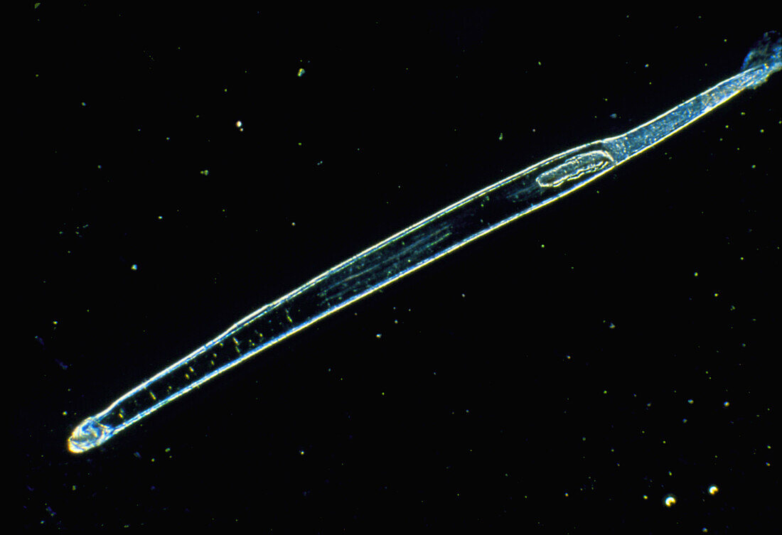 Macrophotograph of an arrow worm (Chaetogna
