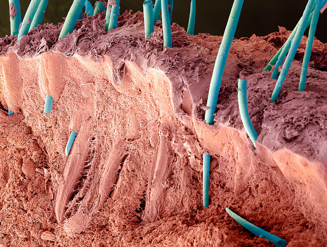 Hedgehog skin and spines,SEM