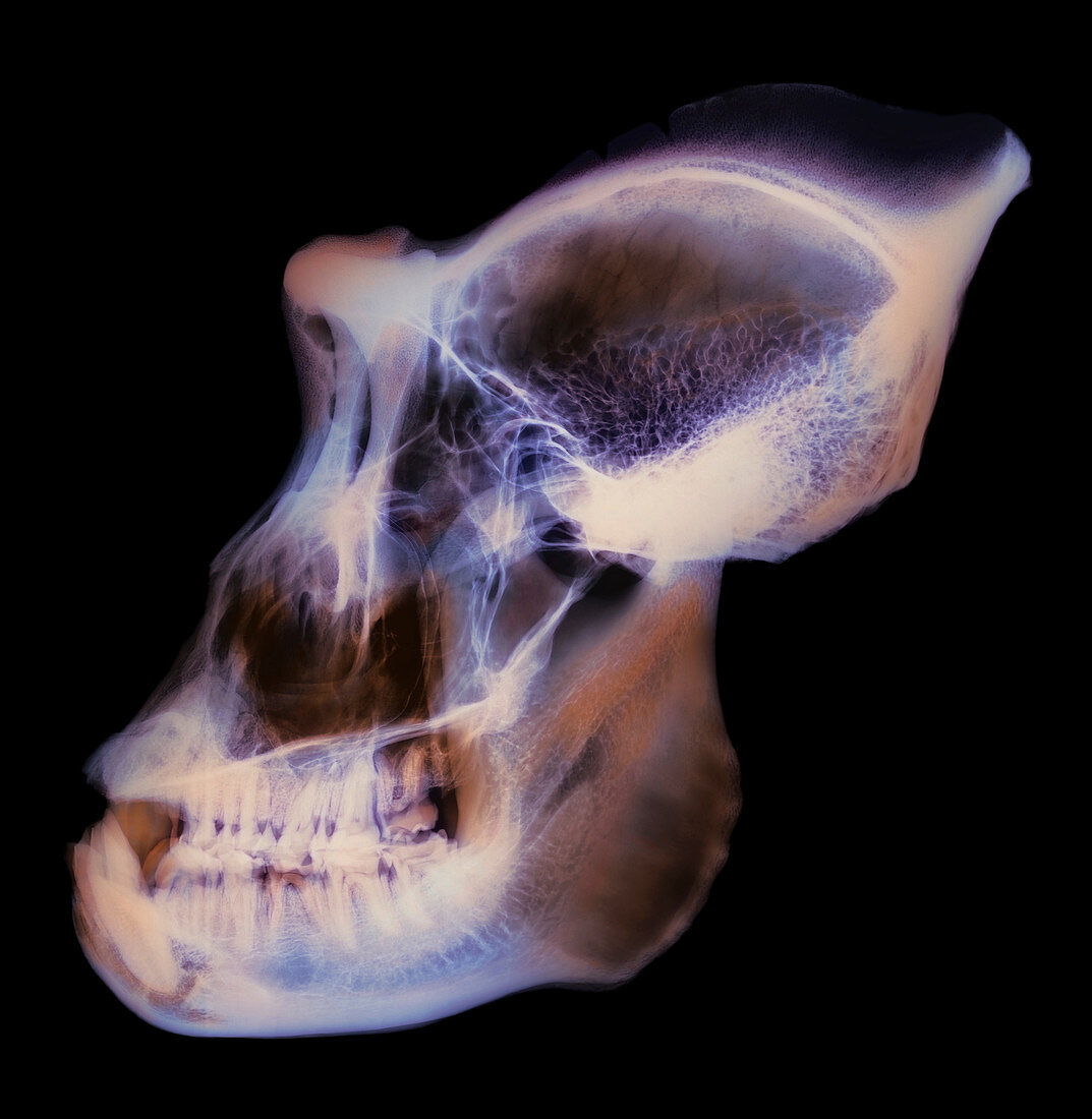 Gorilla skull,X-ray