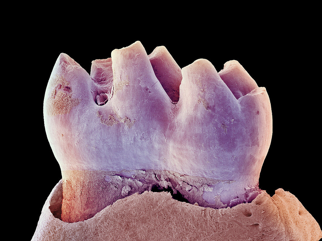 Mouse tooth,SEM