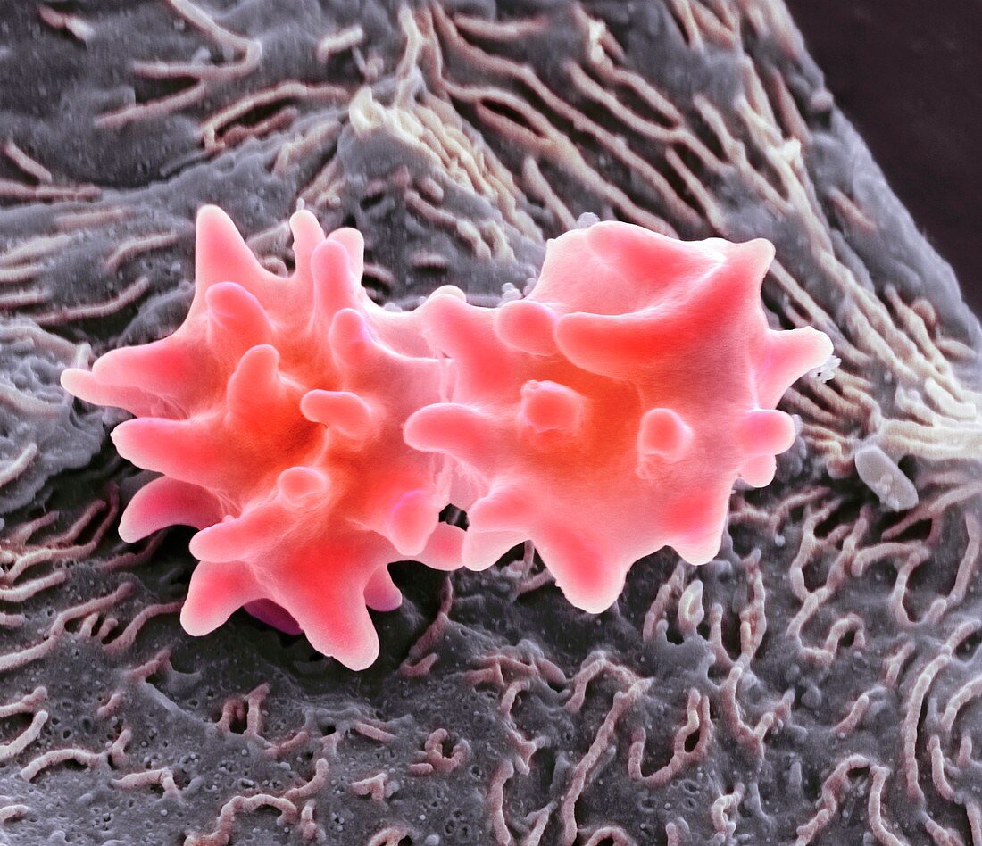 Crenated red blood cells,SEM