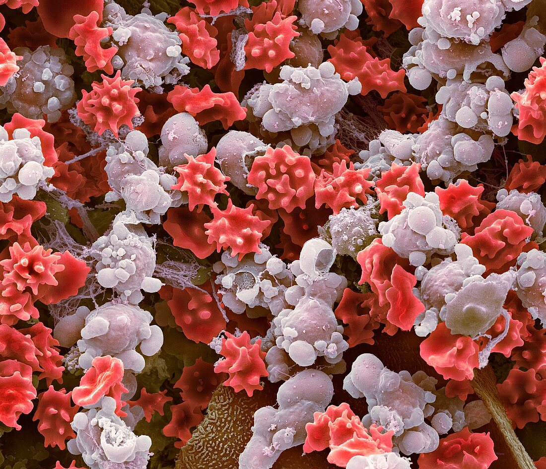 Cells from a urine infection,SEM