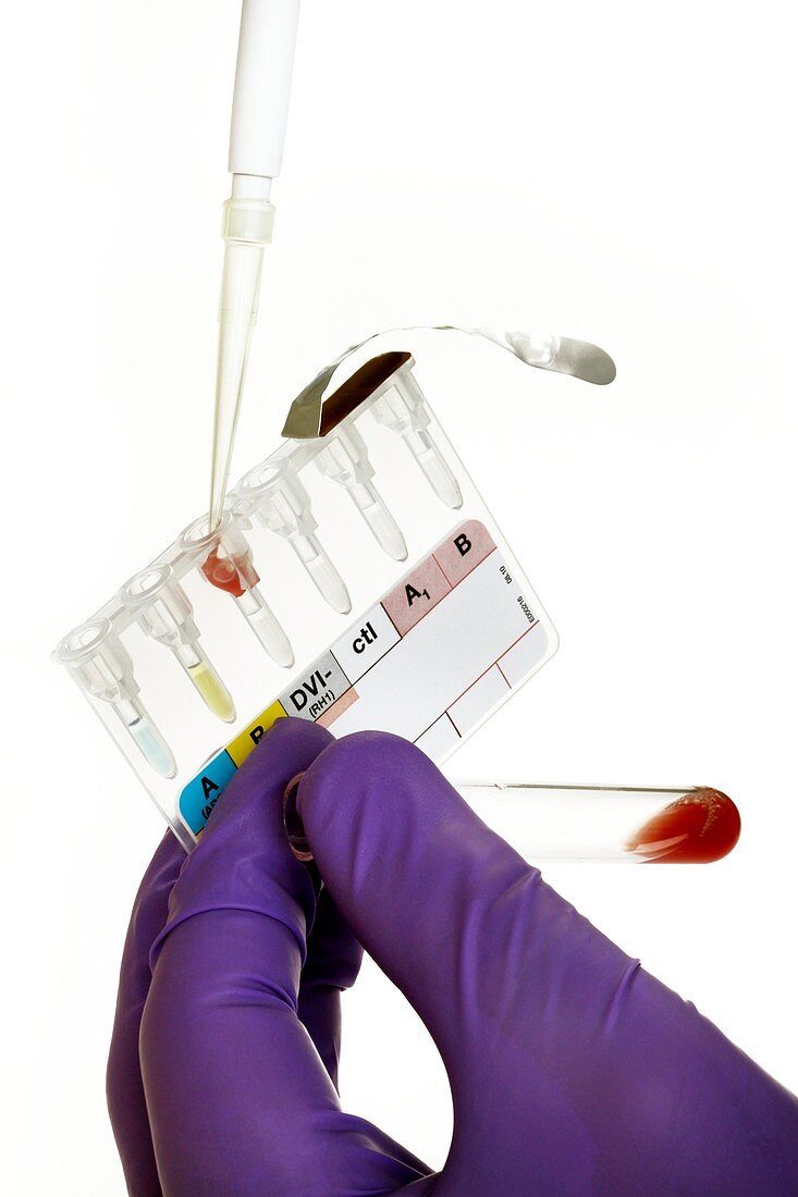 Manual Rhesus test on blood
