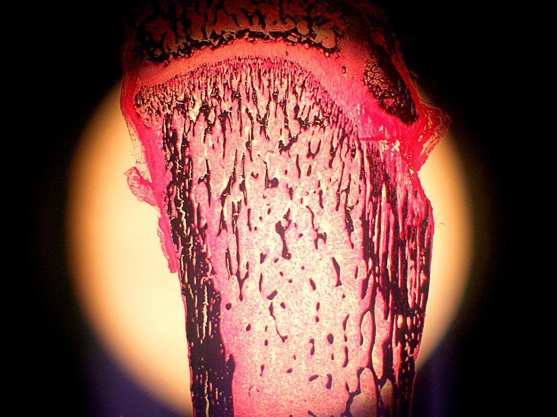 Rat bone,fluorescence micrograph