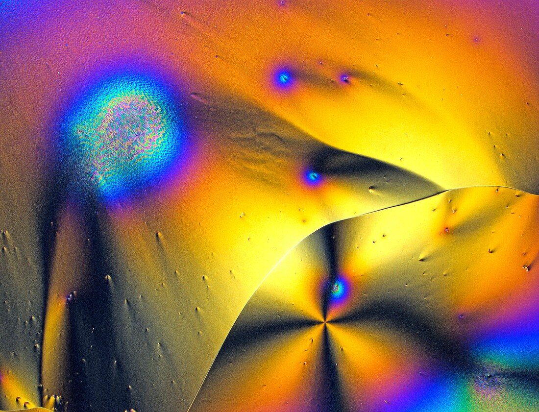 Vitamin C,polarised light micrograph