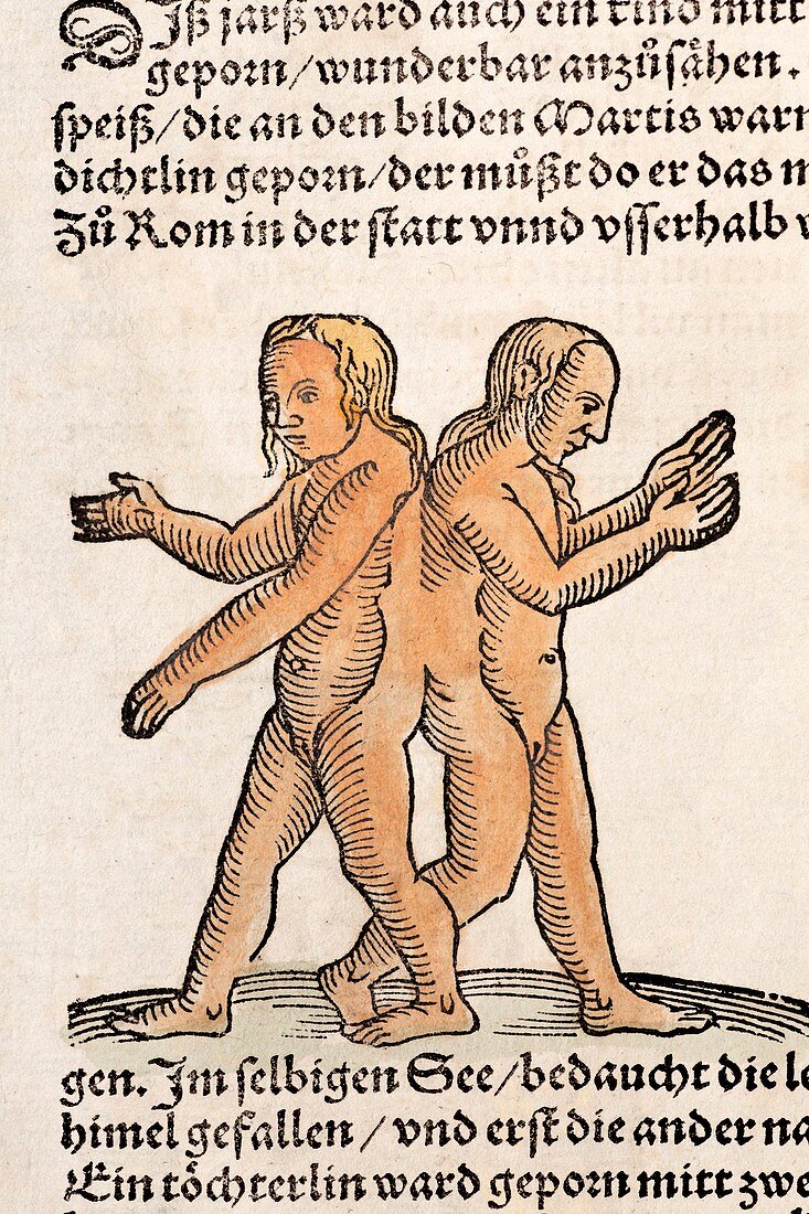 1557 Lycosthenes Conjoined 'Siamese twins