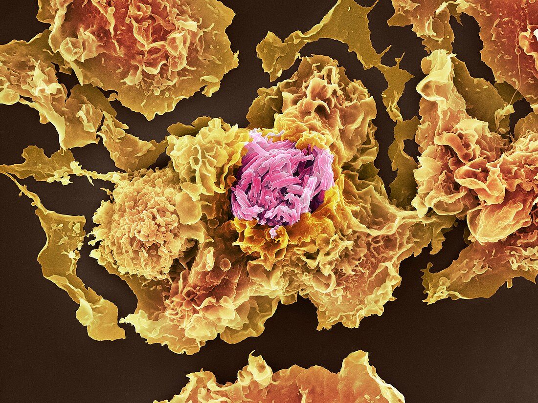 TB bacteria infecting macrophages,SEM