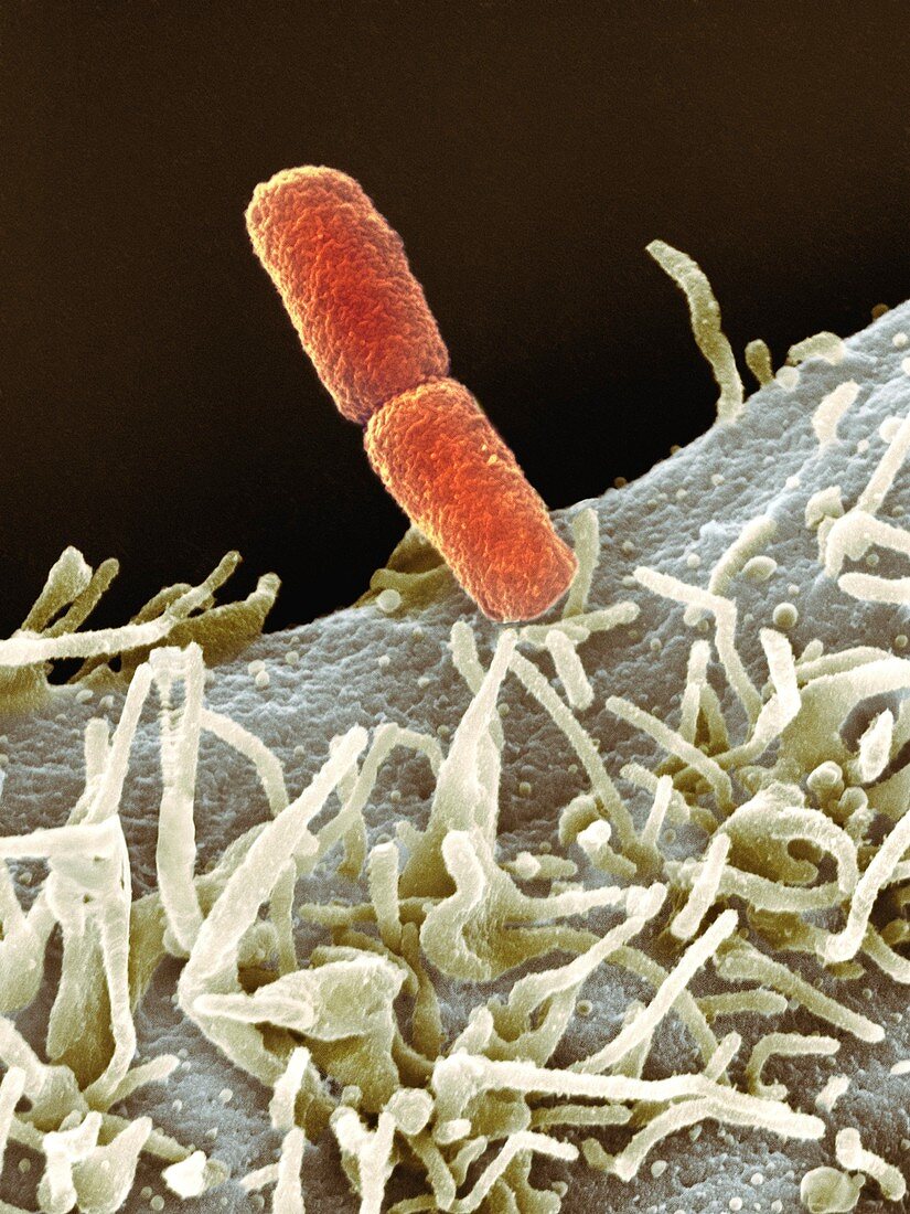 Shigella bacteria,SEM