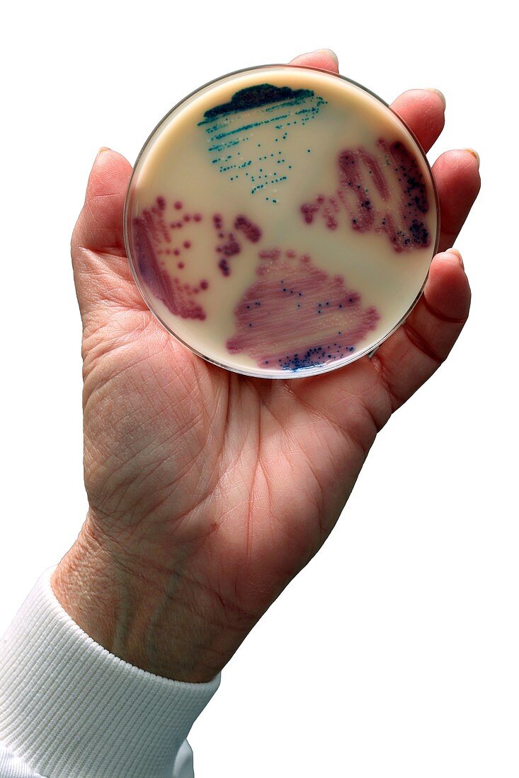 Cultured E.coli and Enterococcus bacteria