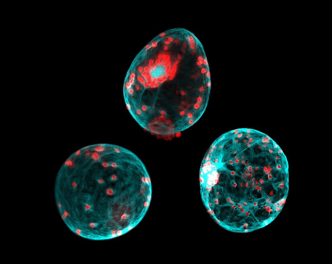 Cell protoplasts,confocal micrograph
