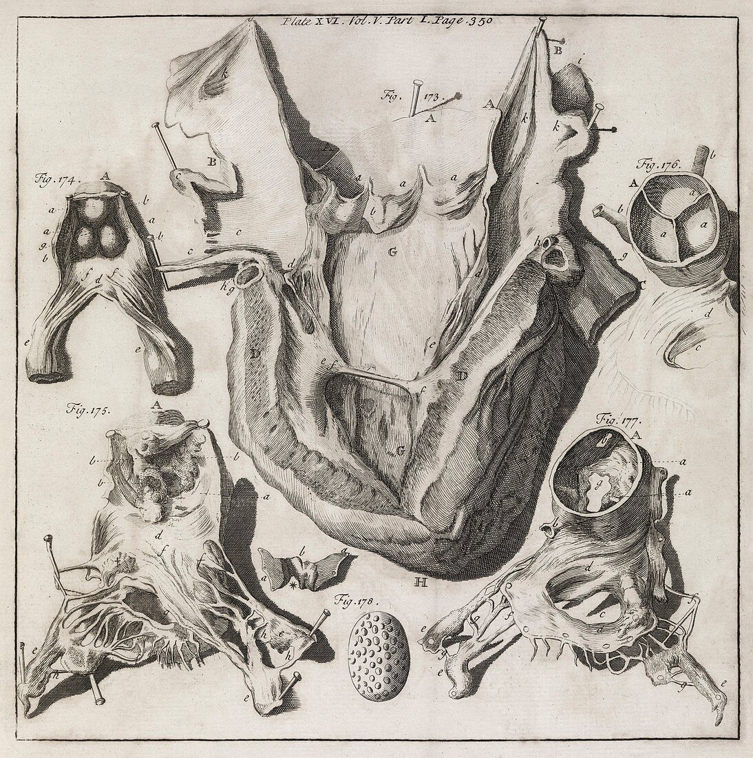 Heart disease,18th century