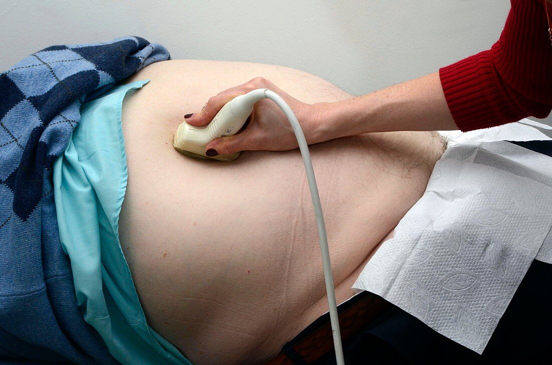 Abdominal ultrasound scanning