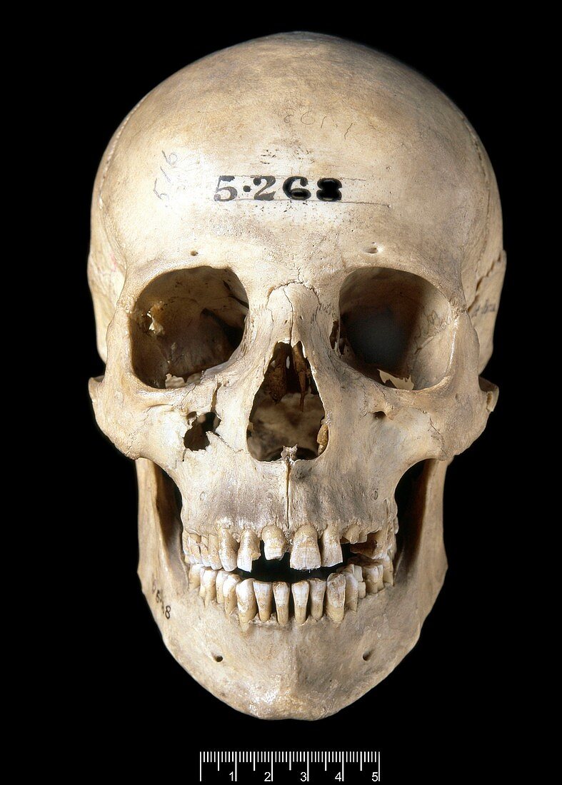 Prehistoric human skull,Etruscan