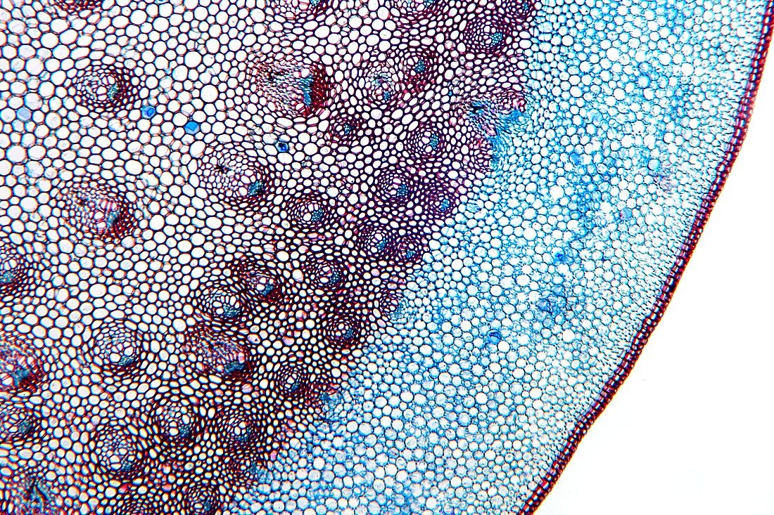 Dracaena draco stem,light micrograph