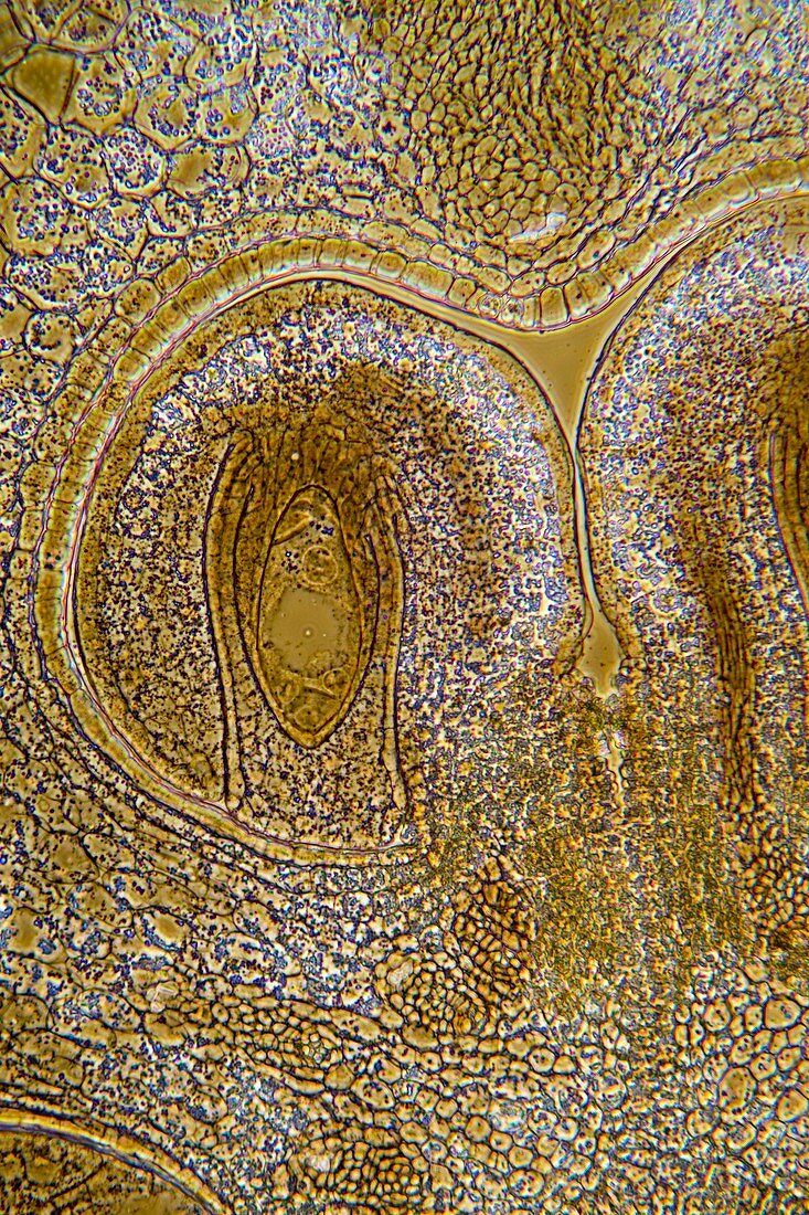 Lily flower ovary,light micrograph