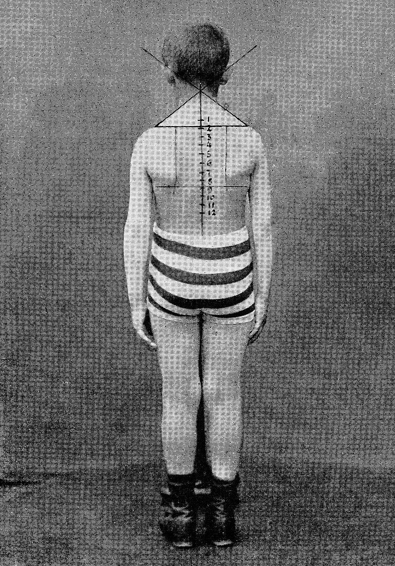 Posture in children,19th century