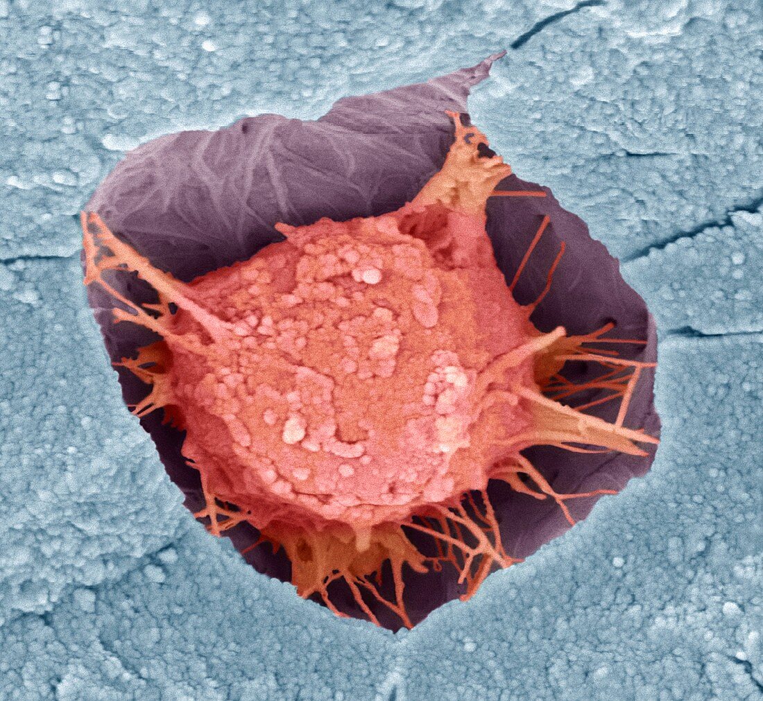 Osteoblast bone cell,SEM