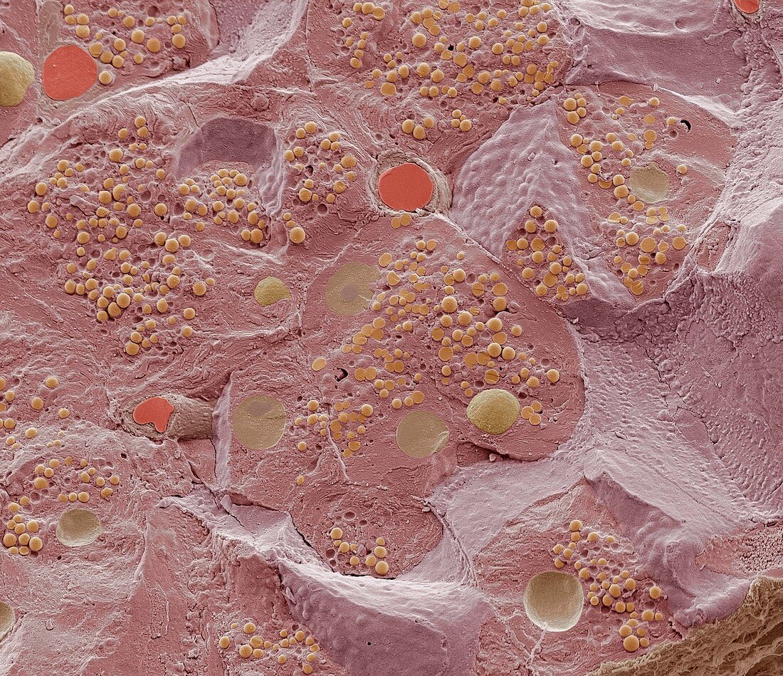 Pancreas tissue,SEM