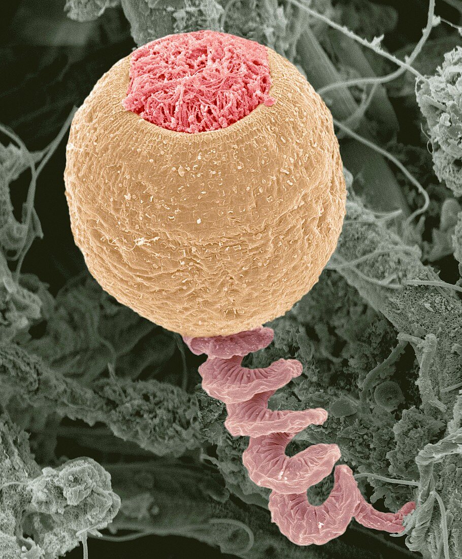Vorticella protozoan,SEM