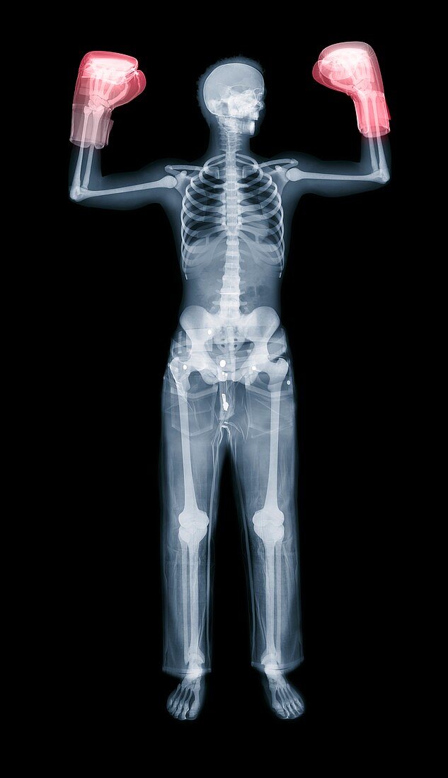 Boxer,X-ray
