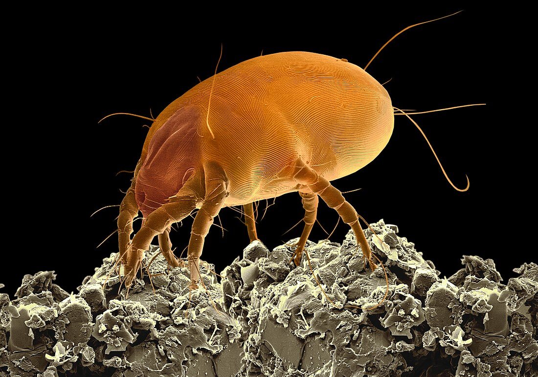 Dust mite,SEM