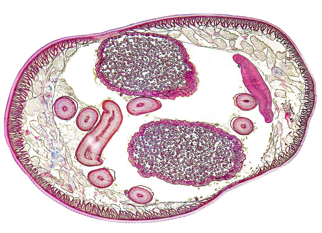 Ascaris roundworm,light micrograph
