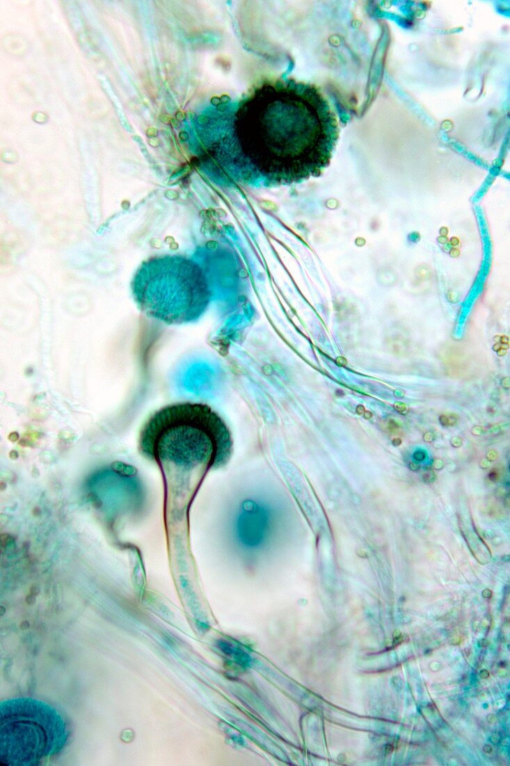 Brown mould fungus,light micrograph