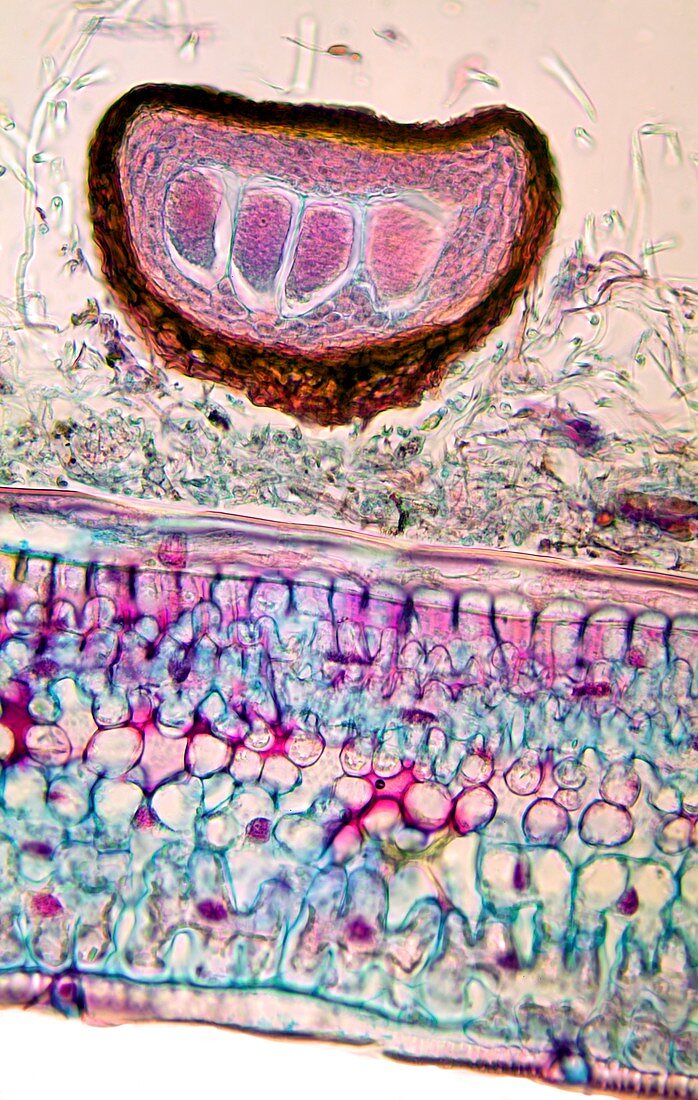 Rose mildew fungus,light micrograph