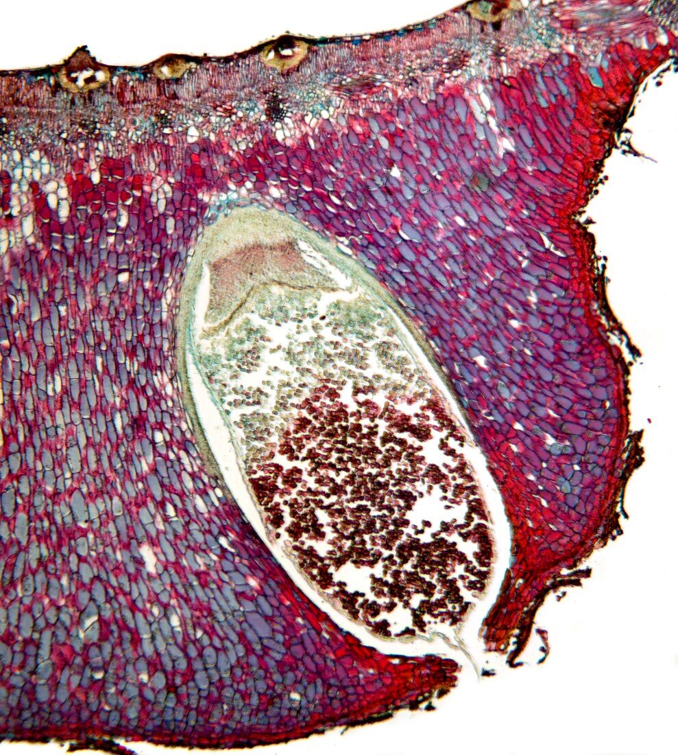 Pear rust fungus,light micrograph