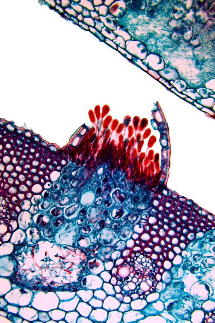 Rust fungus in a leaf,light micrograph