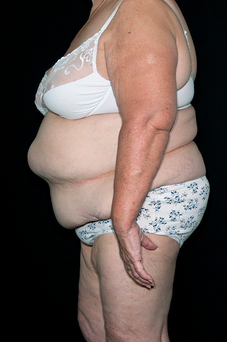 Obese woman in her underwear