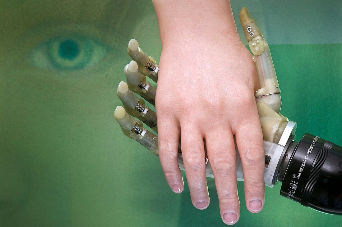 i-LIMB bionic hand and skin prosthesis