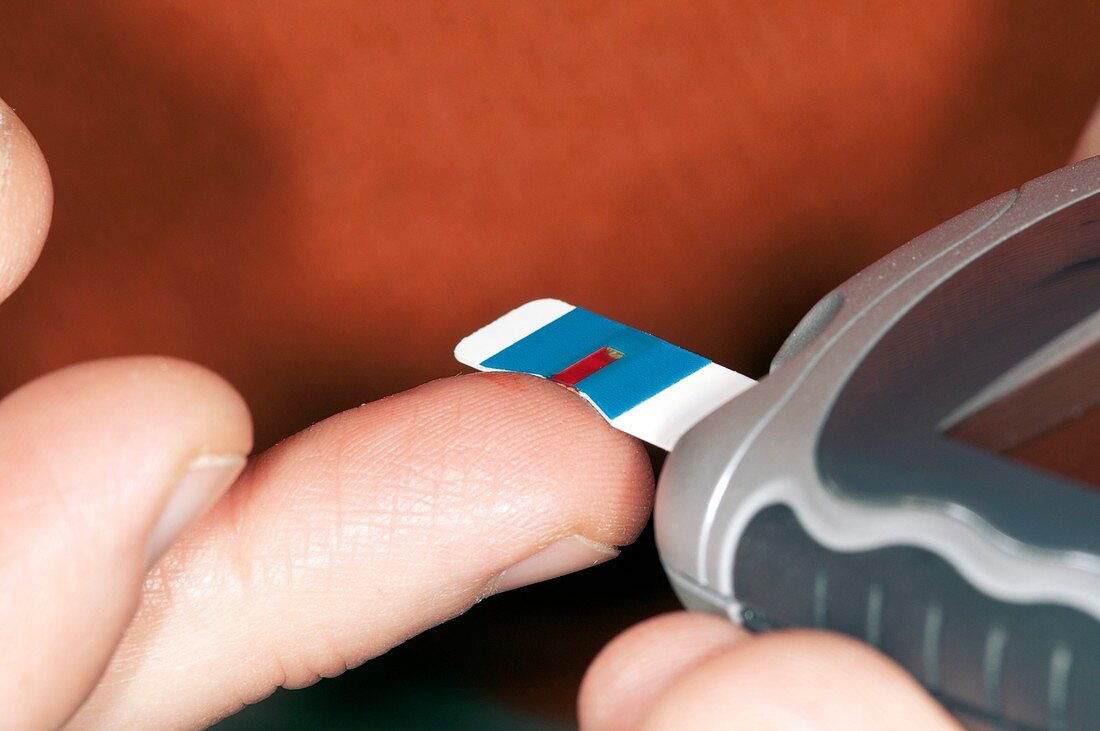 Blood sugar level testing in diabetes