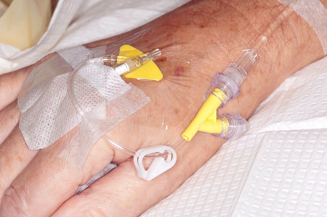 Chemotherapy for cancer patient