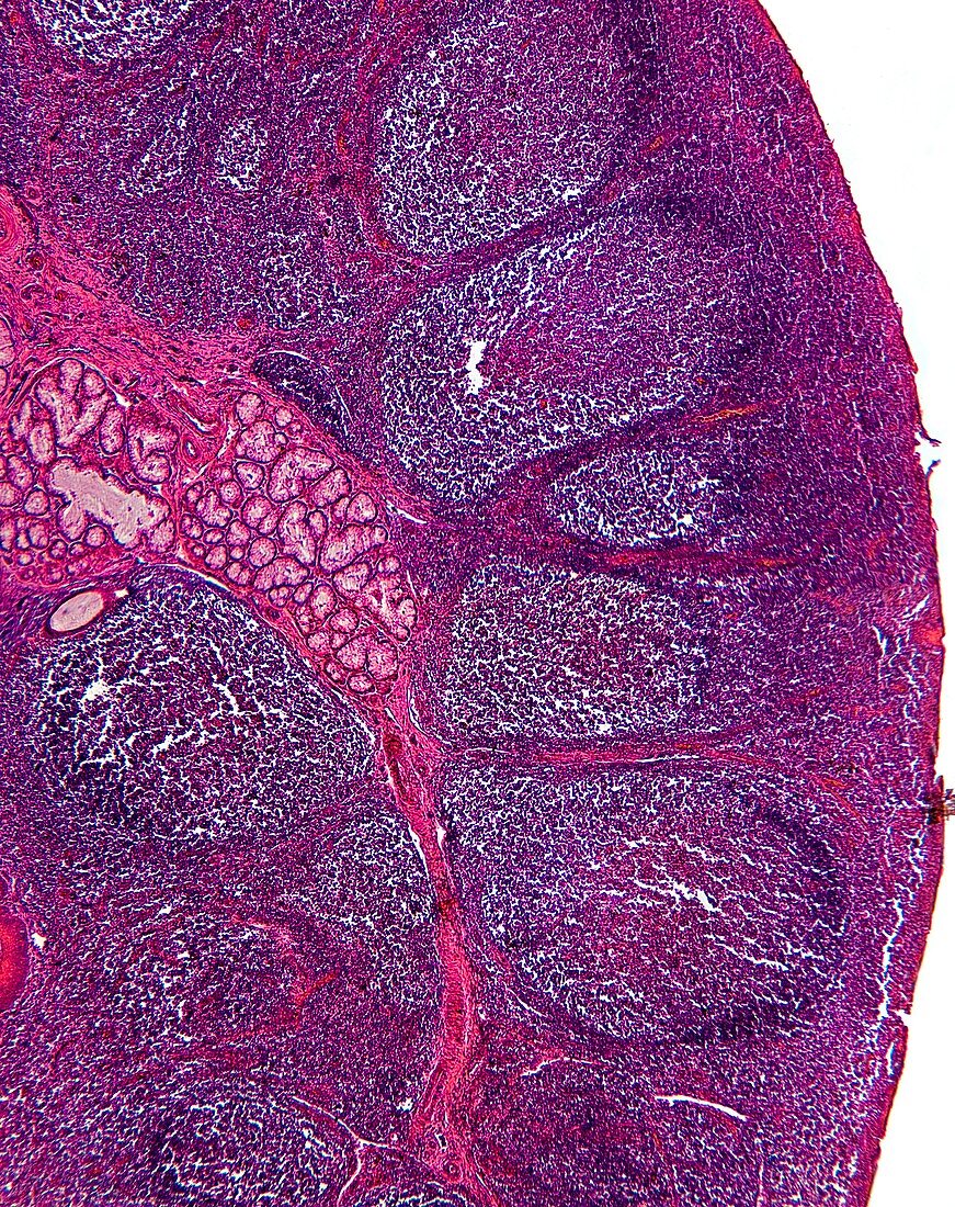 Tonsil tissue,light micrograph