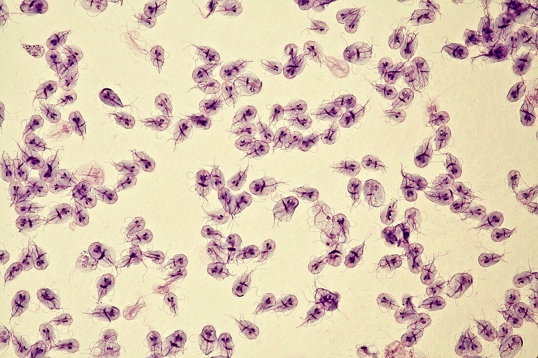 Giardia lamblia protozoa,micrograph