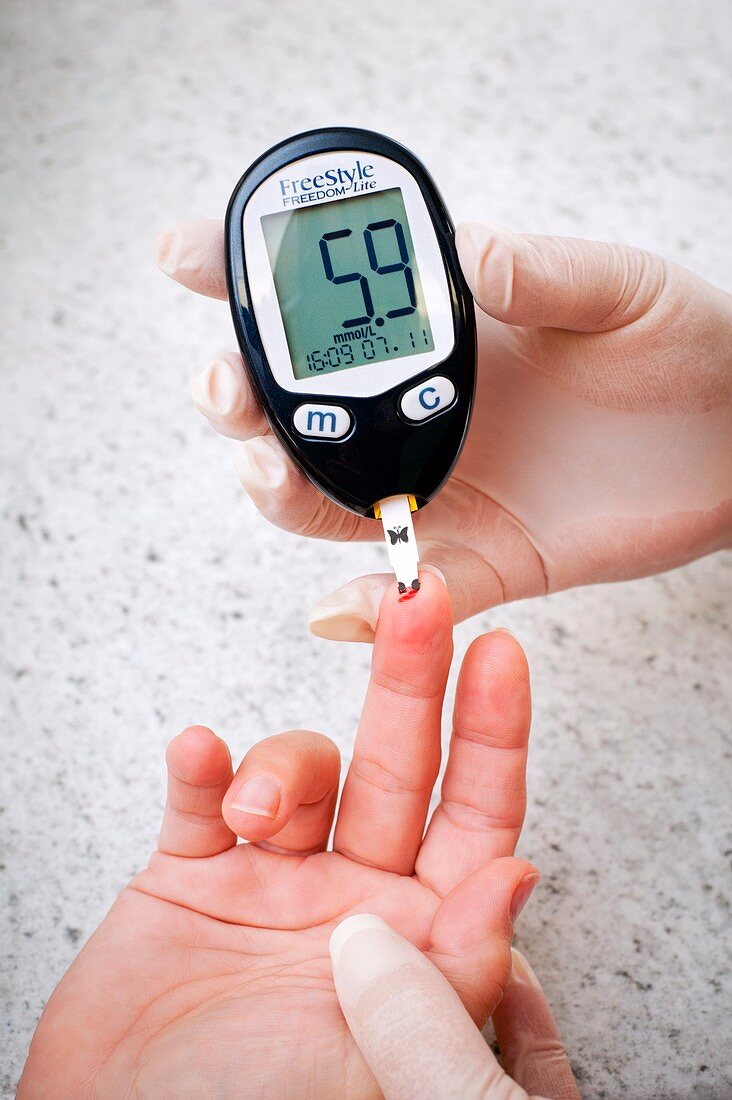 Blood glucose test